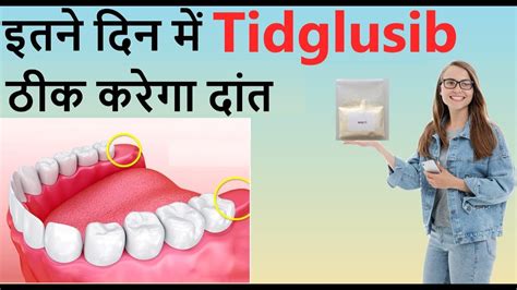 A new study published in Scientific Reports shows that an experimental Alzheimer&x27;s drug called Tideglusib has a small side effect of encouraging dentin growth when applied topically to teeth, causing a tooth to regrow and protect itself from cavities or dental injuries. . Tideglusib toothpaste